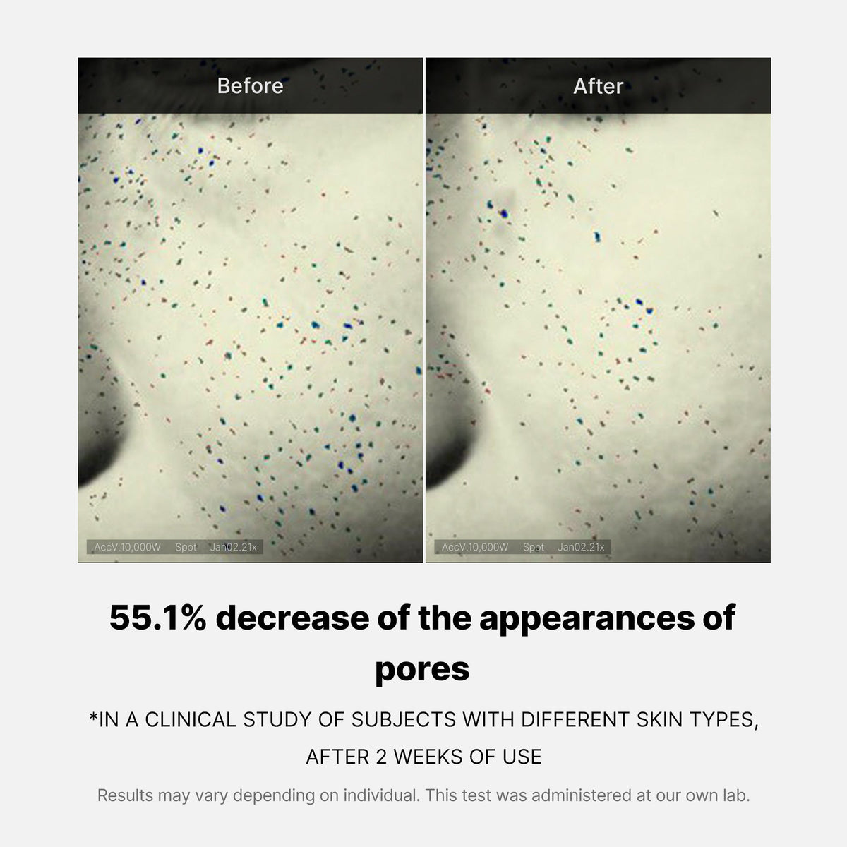 pore-care-duo-f1 05_12ddab8a-64be-4612-8ee1-27e5ec701921.jpg