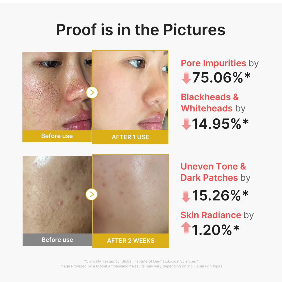kojic-acid-turmeric-peel-shot-s4 02_45fe66d3-b3f6-4100-aa52-2afd7eded417.jpg