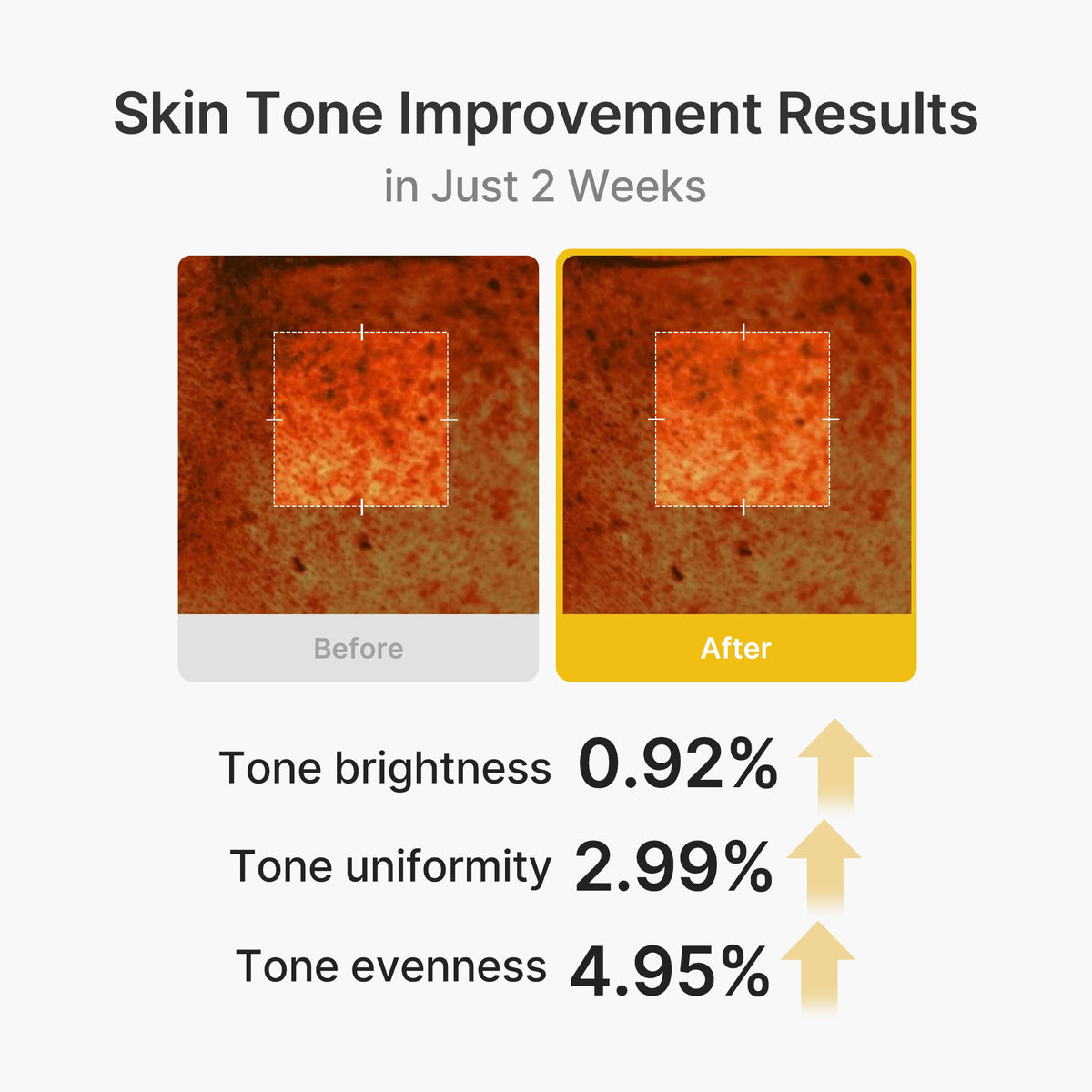 kojic-acid-turmeric-vita-capsule-cream-o1 03_2b626701-fc6c-4702-9e96-a2157a4f7f9d.jpg
