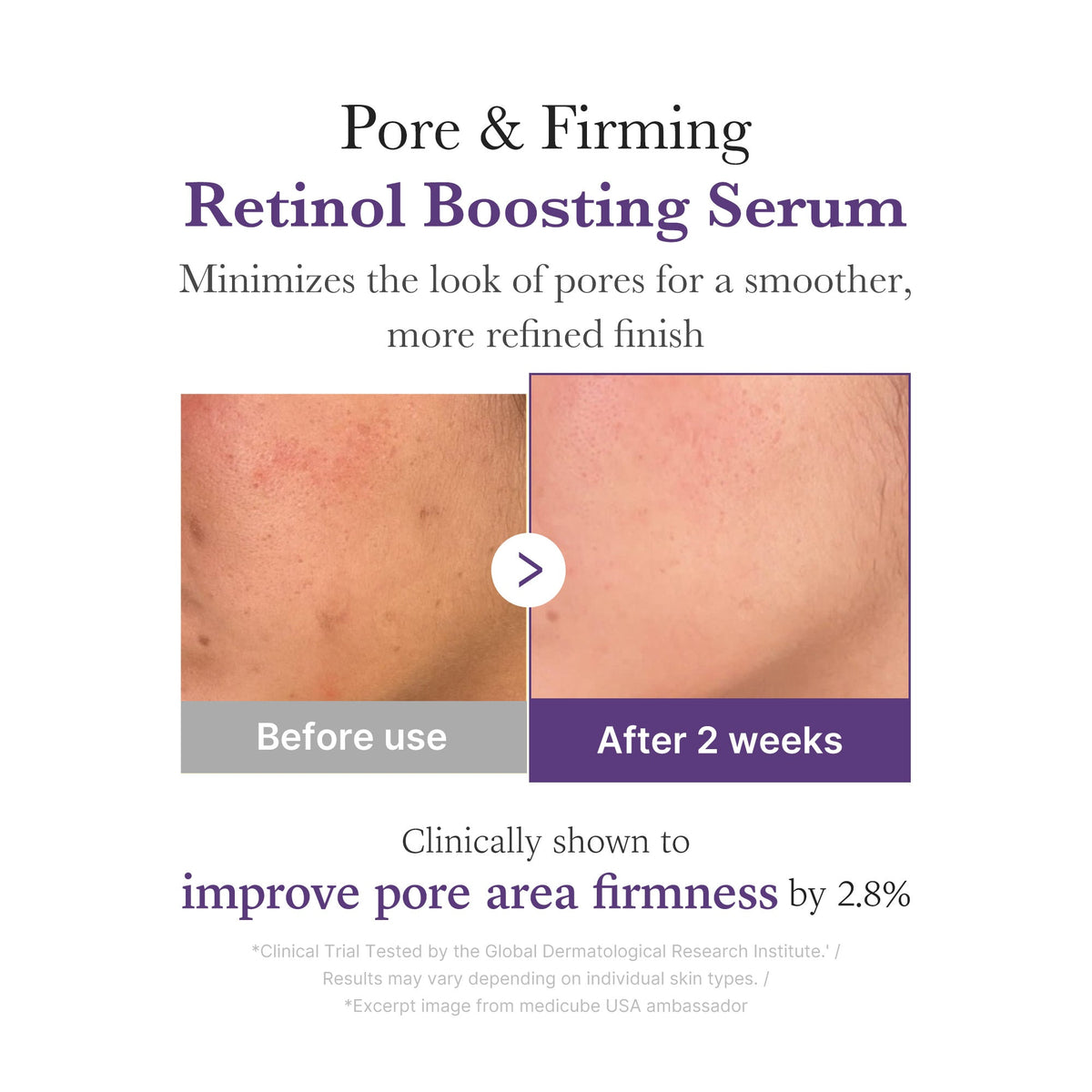 retinol-nmn-boosting-serum-x5 03_3510e7a5-5633-4a18-81ea-1389593bd517.jpg