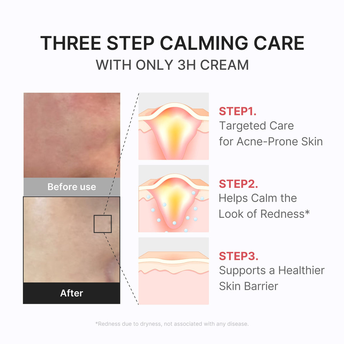 3h-daily-relief-cream-k2 3H_04.jpg
